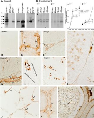 PCSK9 Contributes to the Cholesterol, Glucose, and Insulin2 Homeostasis in Seminiferous Tubules and Maintenance of Immunotolerance in Testis